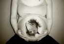 5 Weird Cases of Pregnancy You’ll Never Believe